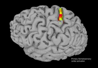 randersen-s1_roionly_view2-news-web fMRI is used to highlight select implant sites in the somatosensory cortex. Electrodes implanted in this region were able to stimulate neurons that produced physical sensations, like a squeeze or tap, in the arm of a paralyzed man. Credit: Courtesy of the Andersen laboratory