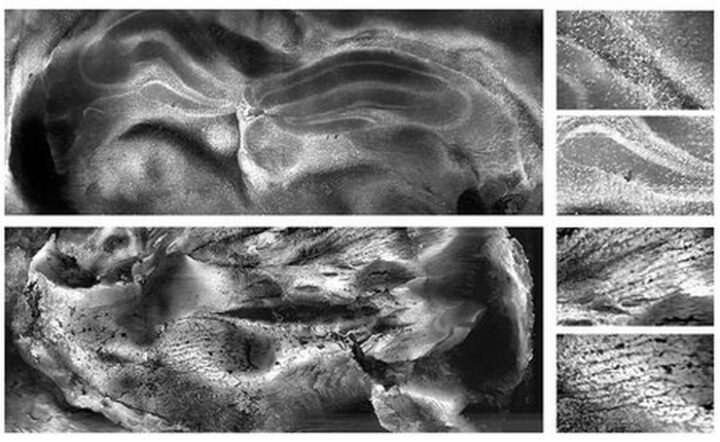 New Caltech-Developed Microscopy Technique Could Enable Rapid Tumor ...